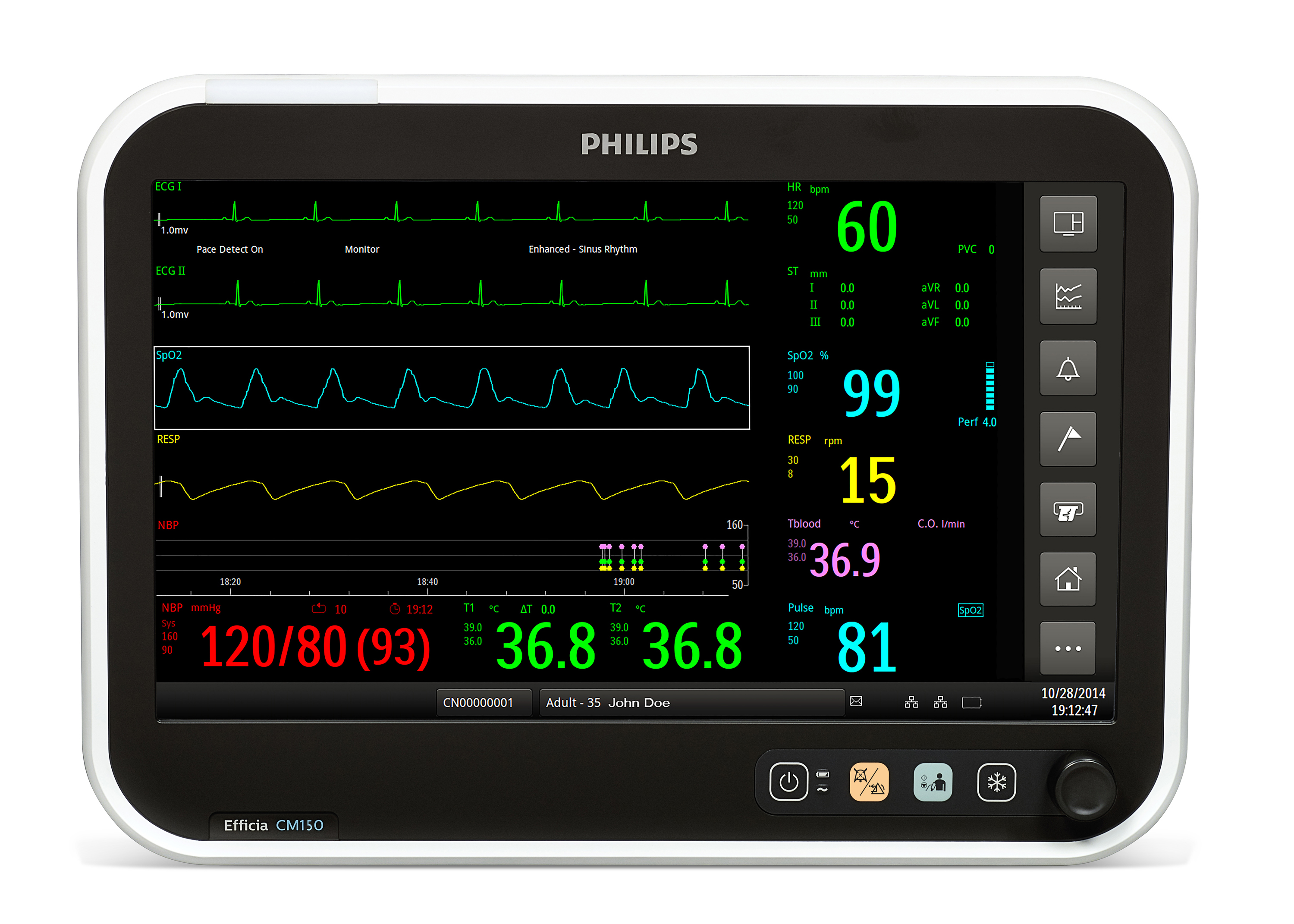 Монитор пациента PHILIPS Efficia CM150