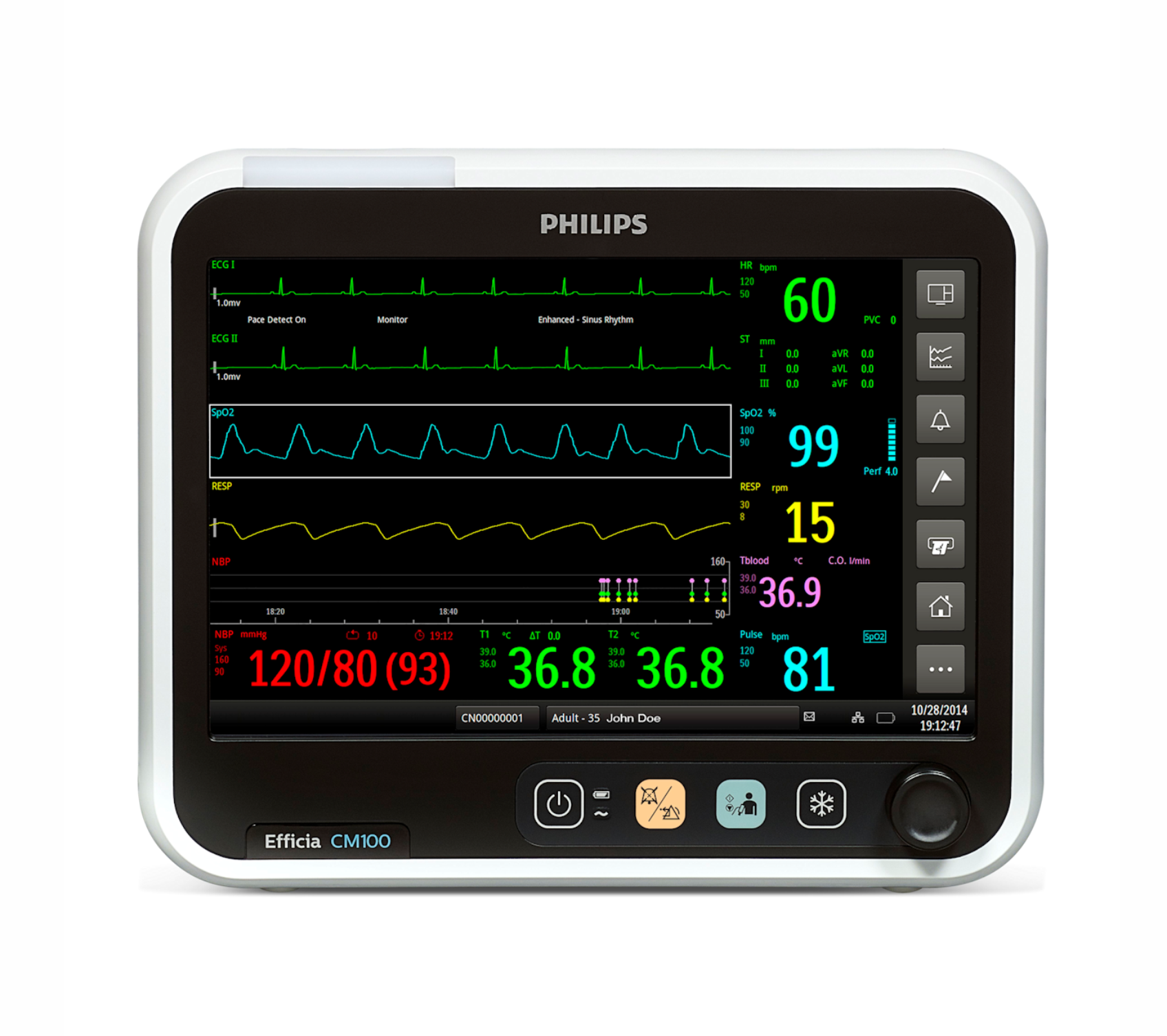 Монитор пациента PHILIPS Efficia CM100