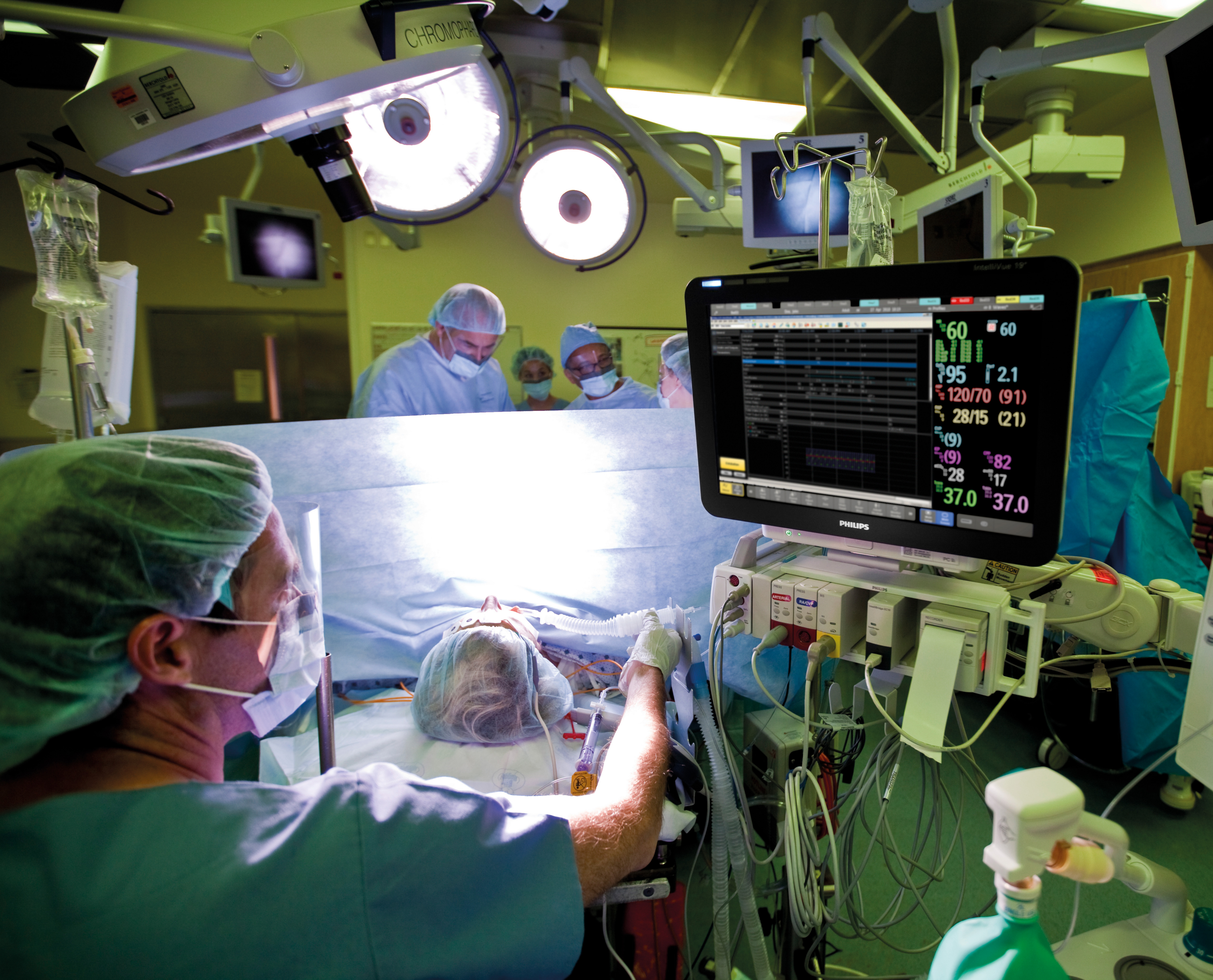 IntelliSpace Critical Care and Anesthesia (ICCA)
