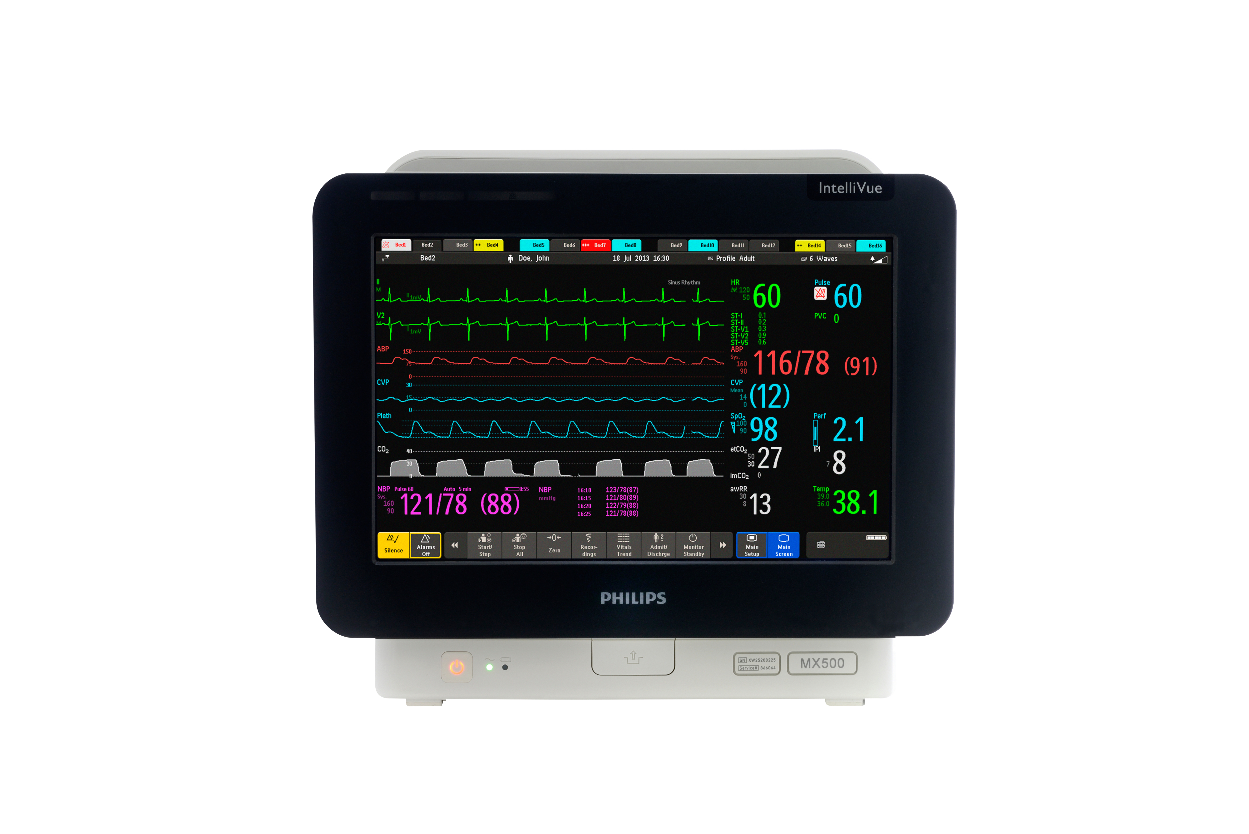 Монитор пациента IntelliVue MX500